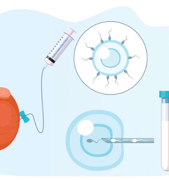 Fertility Treatment Centre in Chennai - PSFC