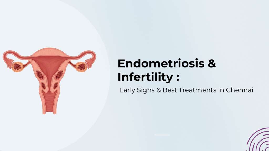 Endometriosis & Infertility: Early Signs & Best Treatments in Chennai