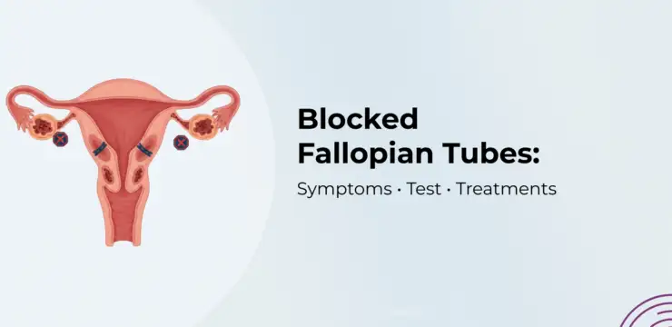 Woman concerned about infertility due to blocked fallopian tubes, medical illustration of reproductive system and treatment options at Pearl Singapore Fertility Centre Chennai