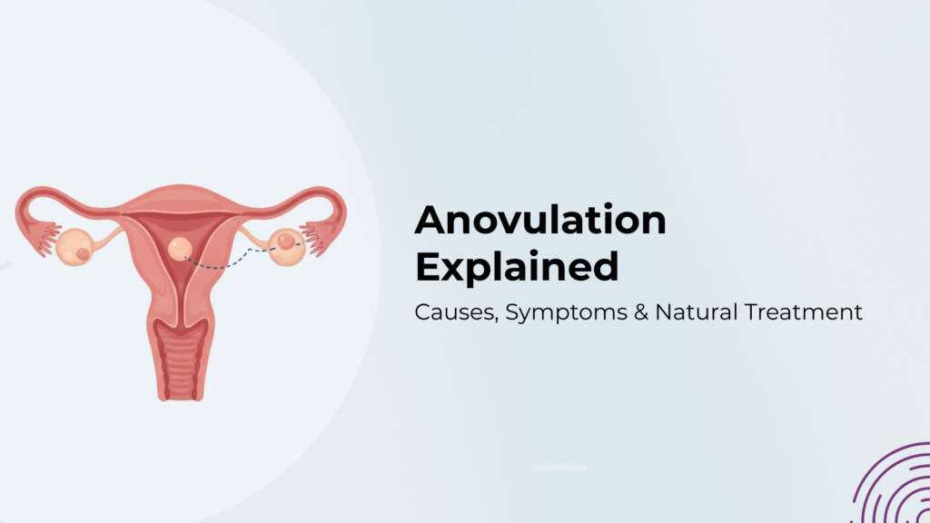 Anovulation Explained: Causes, Symptoms & Natural Treatment