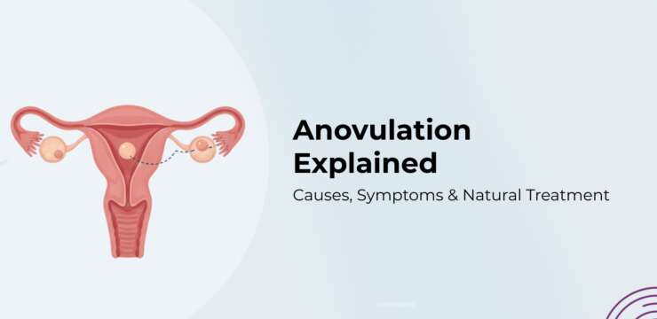 Anovulation explained – causes, symptoms, and natural ways to restart ovulation safely