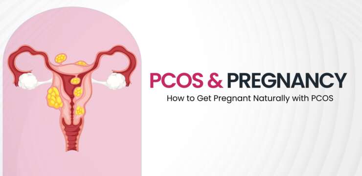 Woman with PCOS consulting a fertility specialist about natural conception strategies