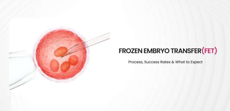 : A close-up view of a frozen embryo transfer (FET) procedure, with a needle carefully placing embryos into a prepared environment.