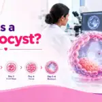 What Is a Blastocyst? Meaning, Stages, Grading & Success Rate in IVF